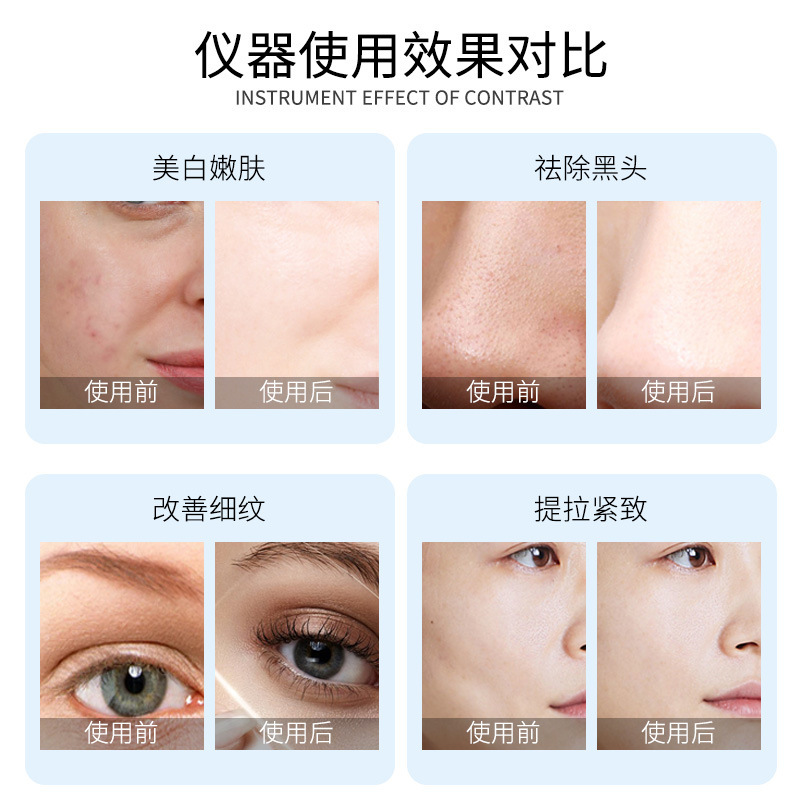 皮膚総合管理器美容院専用顔面多機能清潔補水導入引き上げ酸素全能器|undefined