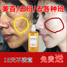 祛斑美白精华液袪黄褐斑雀斑改善暗沉提亮肤色淡化色素光甘草定
