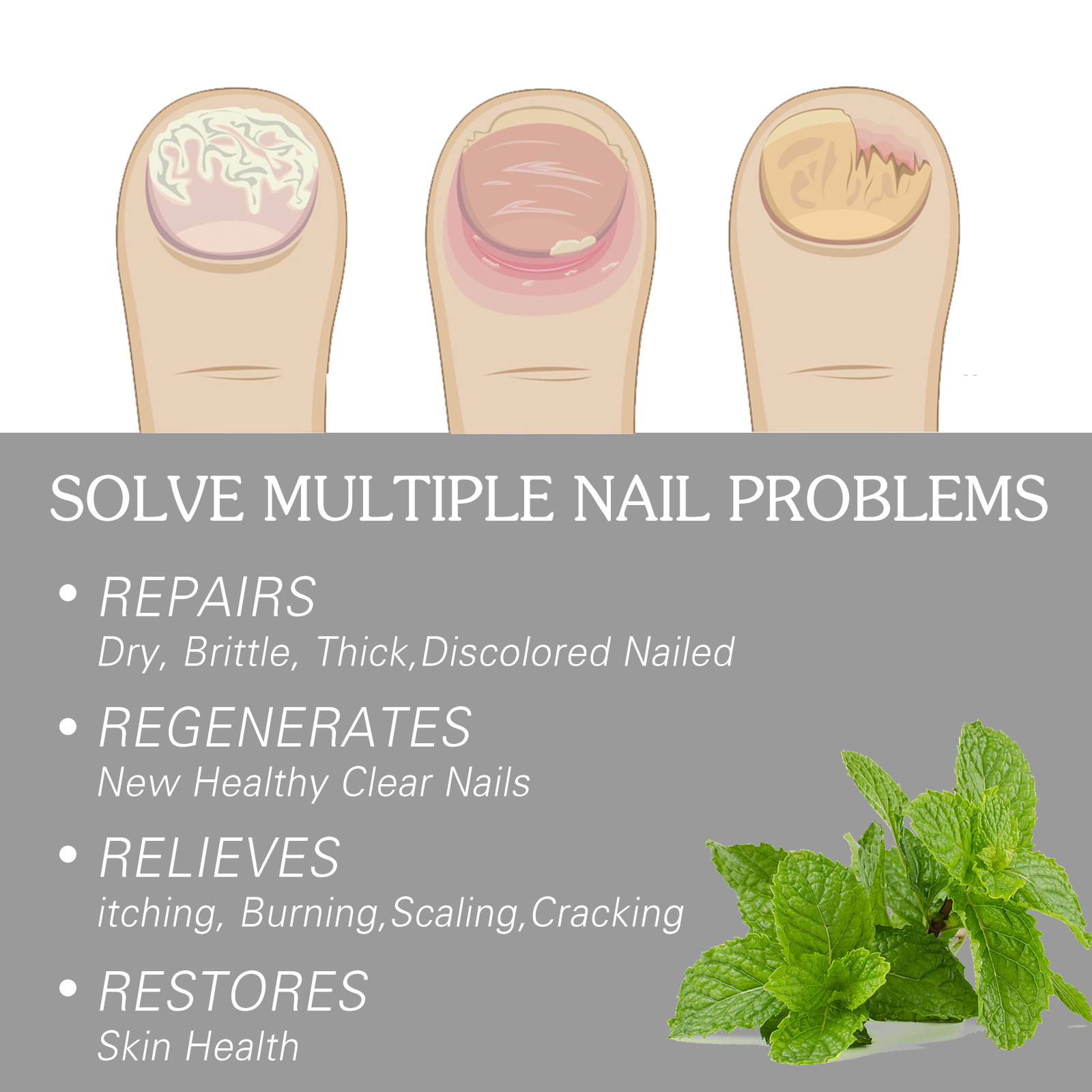 EELHOE gel Repair Hand, Foot, Grey Groin, Soft Nail, Moisturizing and Shining Nail Care_voghion.com
