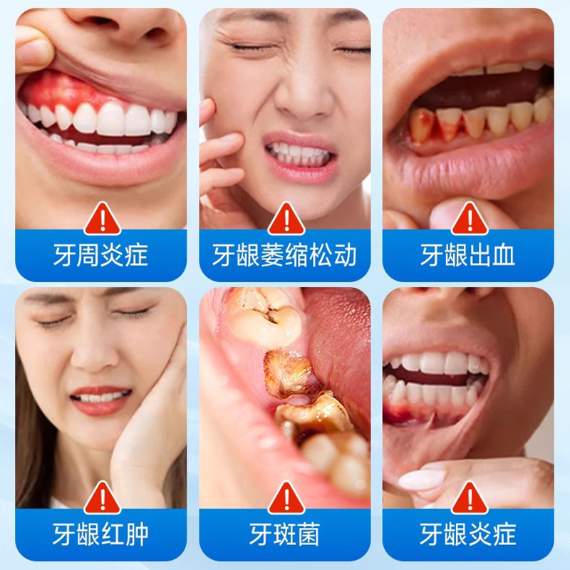 ひまわり医療口腔ケア減感作クリームは歯のアレルギー症状を和らげます、非歯磨き粉 Douyin Kuaishou の人気のドロップシッピング|undefined