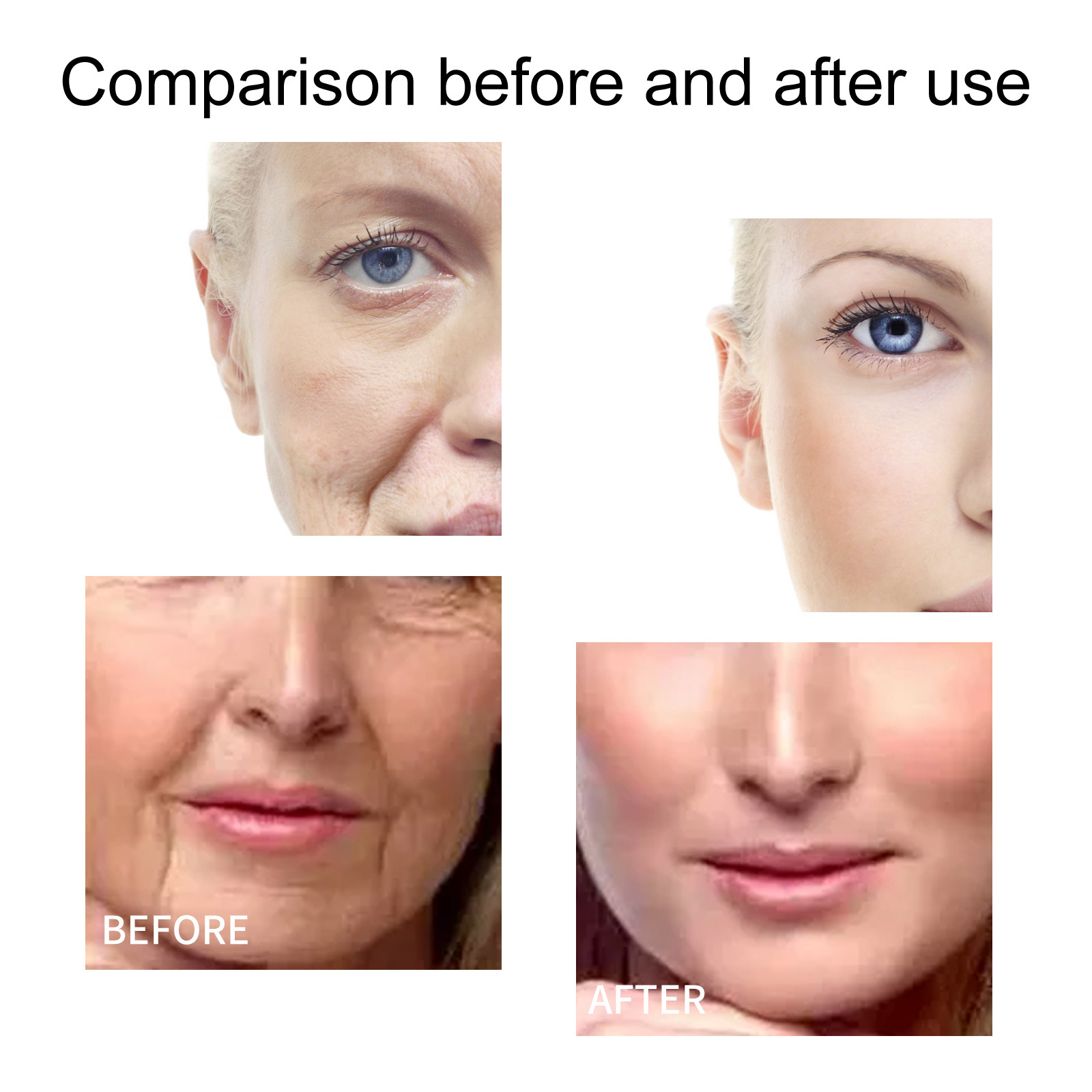 L'essenza pre-fiala di ceramide EELHOE indebolisce le linee sottili, ricostituisce l'acqua e il collagene può migliorare l'antirughe della pelle_voghion.com