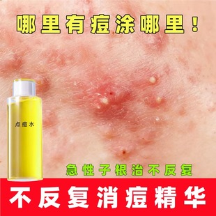 �c��ˮ����AҺ���ഺ���̋���������������\�]�ں��^�۴����z