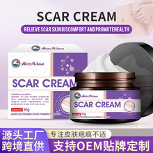 Ӣ��ϵ�п羳؛Դ�̺۸� Ƥ�w�̺����g�̺۶��Ӳ��mƤ�w���ø��w