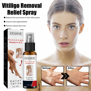 EELHOE White Spot Repair Spray Repair Fades White Spot Spotty Sweat Spot Skin Moisturizing Skin Care Spray