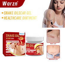 Warzn�羳���R�d���Ͱ̺۸����uͨ���N Ƥ�w�o�����������Q���l