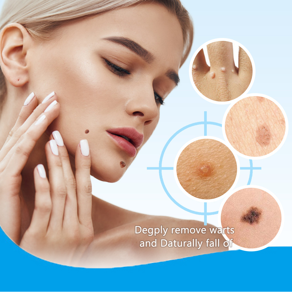 Skin Tag-Reinigungsflüssigkeit zur Wachstumskontrolle, Hühneraugenklappe und Entfernung von Dornwarzen_voghion.com