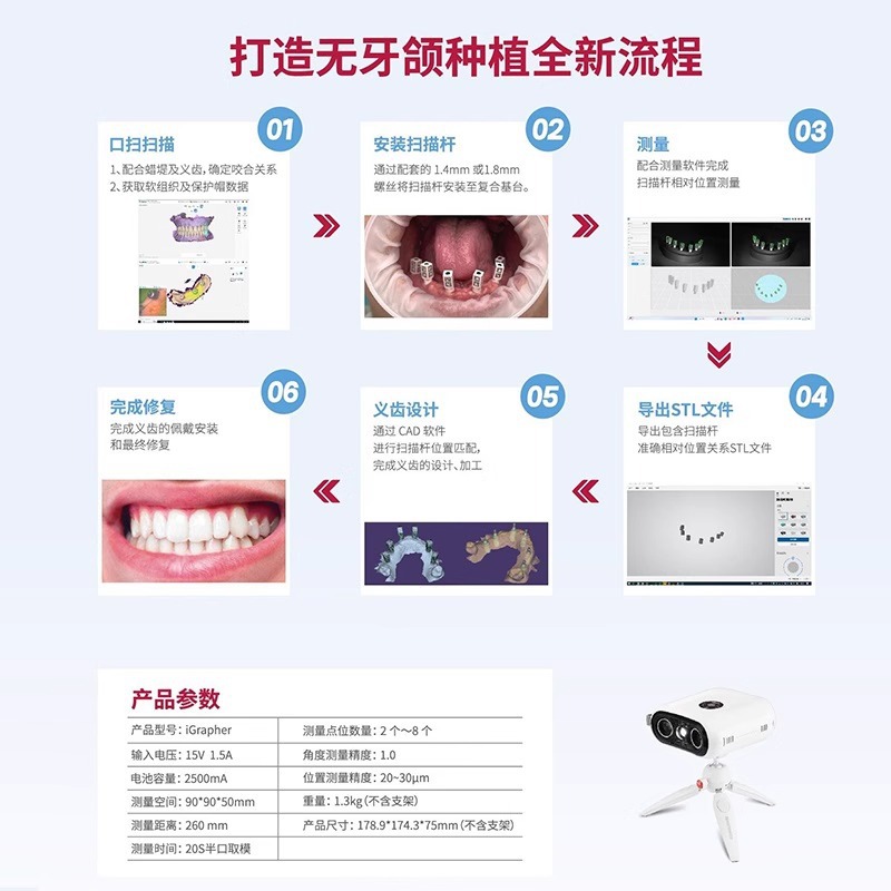Localizador de implantes digitales orales Localizador dental Detector 3D Detector de reparación