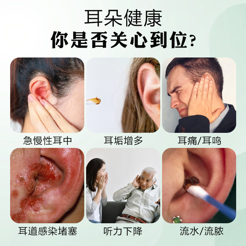 德国靡浩览娅耳康宁膏耳部不适耳鸣耳痒耳部嗡嗡作响日常护理膏|undefined