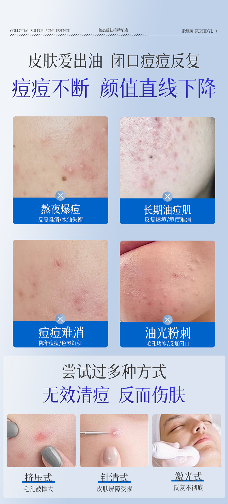 AOPY Colloidal Sulfur Acne-Fighting Essence Effective Acne Removal Improves Acne-Prone Skin Reduces Pimples and Blackheads Salicylic Acid Acne-Treating Liquid