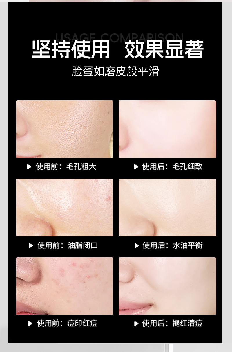 Cross-Border Exclusive Facial Oil Control & Acne-Fighting Toner with 2% Salicylic Acid - Blackhead Removal, Exfoliating & Pore-Minimizing Essence