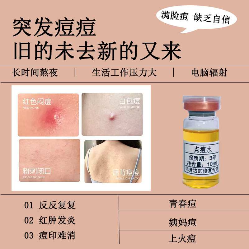 点痘水植物萃取浓缩精华淡化痘印痤疮祛闭口粉刺加速瘪痘一天起效|undefined