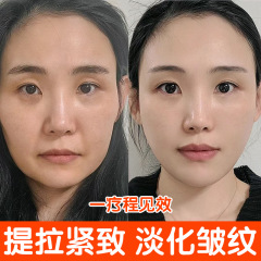 コラーゲン充填クリーム、額のしわやほうれい線を除去する再構築クリーム、男性と女性のための抗シワ引き締め保湿クリーム、アンチエイジング