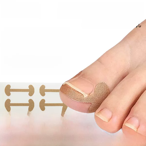 Glue-free nail paste toe nail into the meat long nail groove embedded special isolation bone-shaped nail correction and correction paste