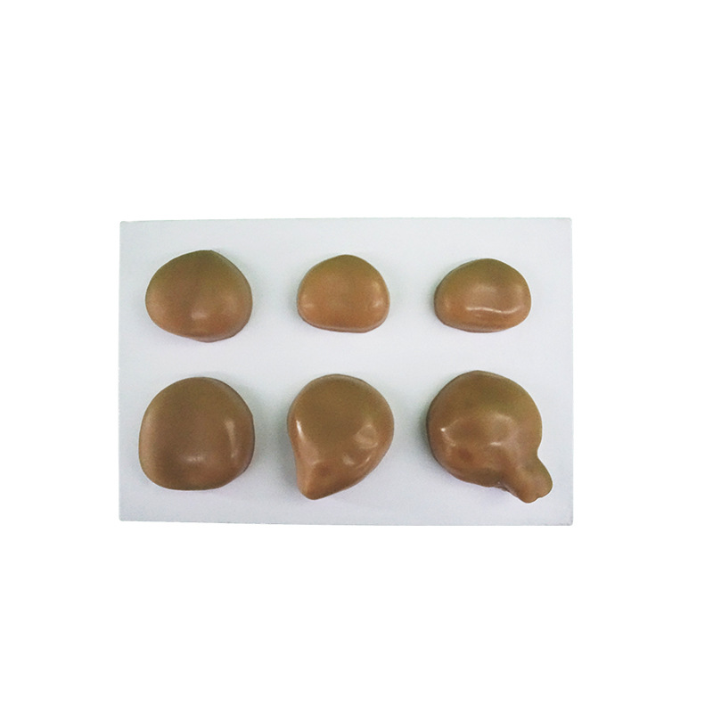 U071A prostate normal and lesion demonstration model
