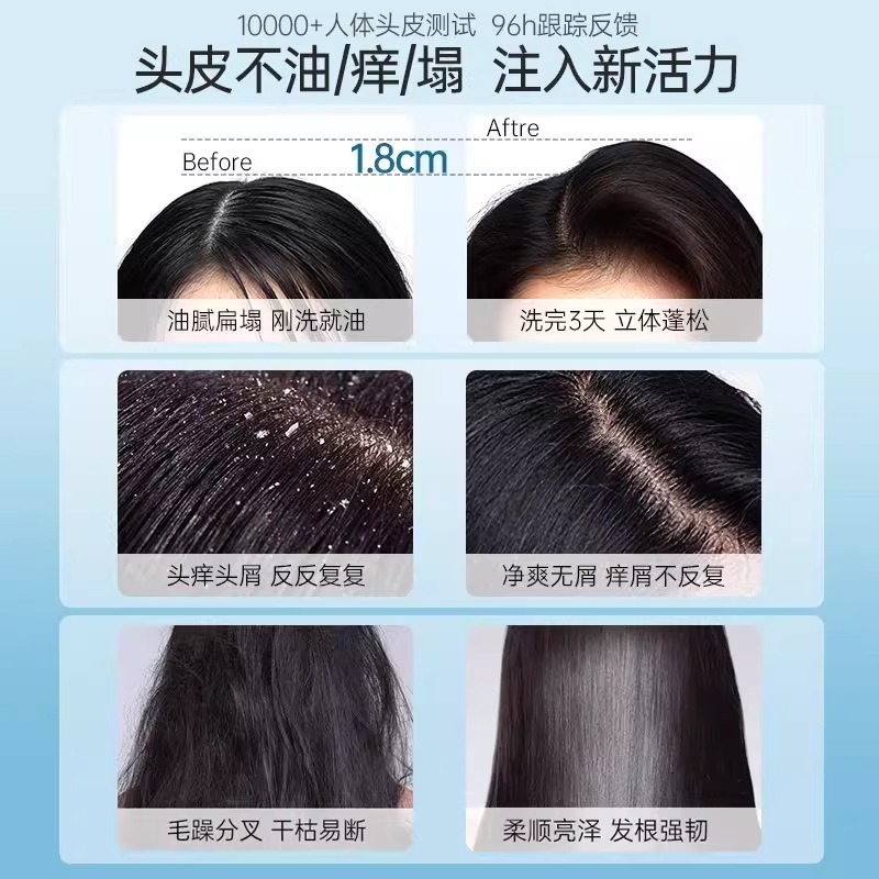 OHBT澳白洗发水控油去屑止痒头皮深层清洁滋养蓬松品牌洗发露|undefined