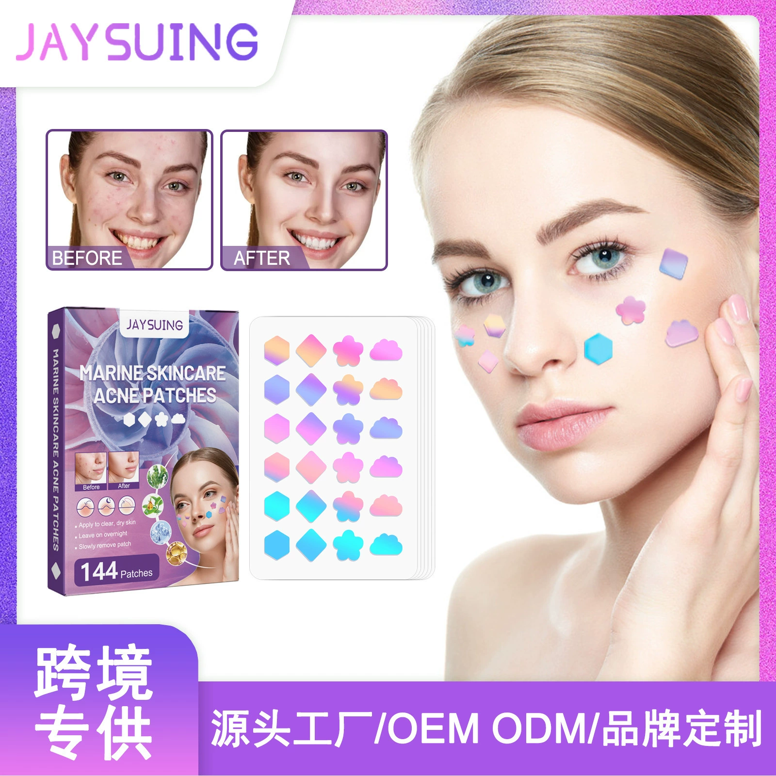 Цветные наклейки Jaysuing для исправления дефектов прыщей, устранение бутыл ожог воды, патч для кожи