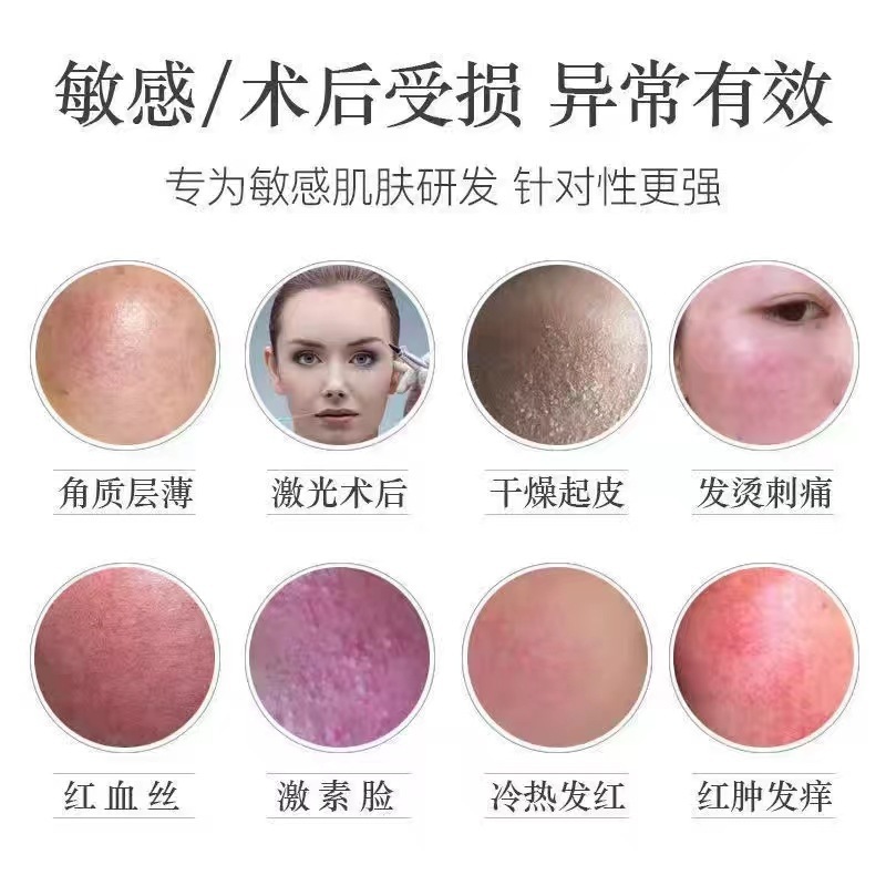 美容サロン修復因子ジェル、タトゥー跡、ほくろ除去、赤み軽減、ピコ秒エッセンス、皮膚剥離、アイスクリスタルスキンケア、日焼け後の修復|undefined