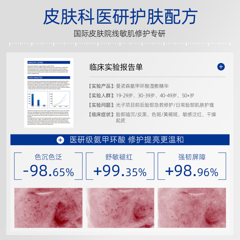 5%氨甲环酸湿敷液面部提亮暗沉舒缓外用保湿精华液体贴牌定制代发|undefined