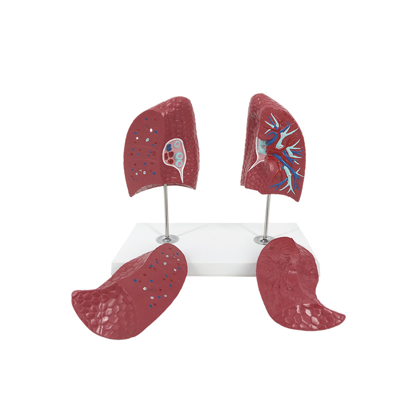 R041 Lung anatomical model