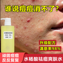 水杨酸爽肤水高浓度痘肌修护淡化痘印青春痘收缩毛孔壬二酸2%原液