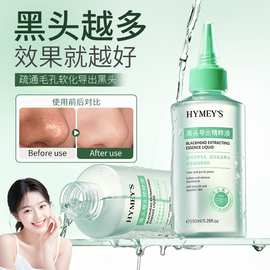 形象美黑头导出精粹液温和清洁黑头白头粉刺闭口清洁毛孔精华液