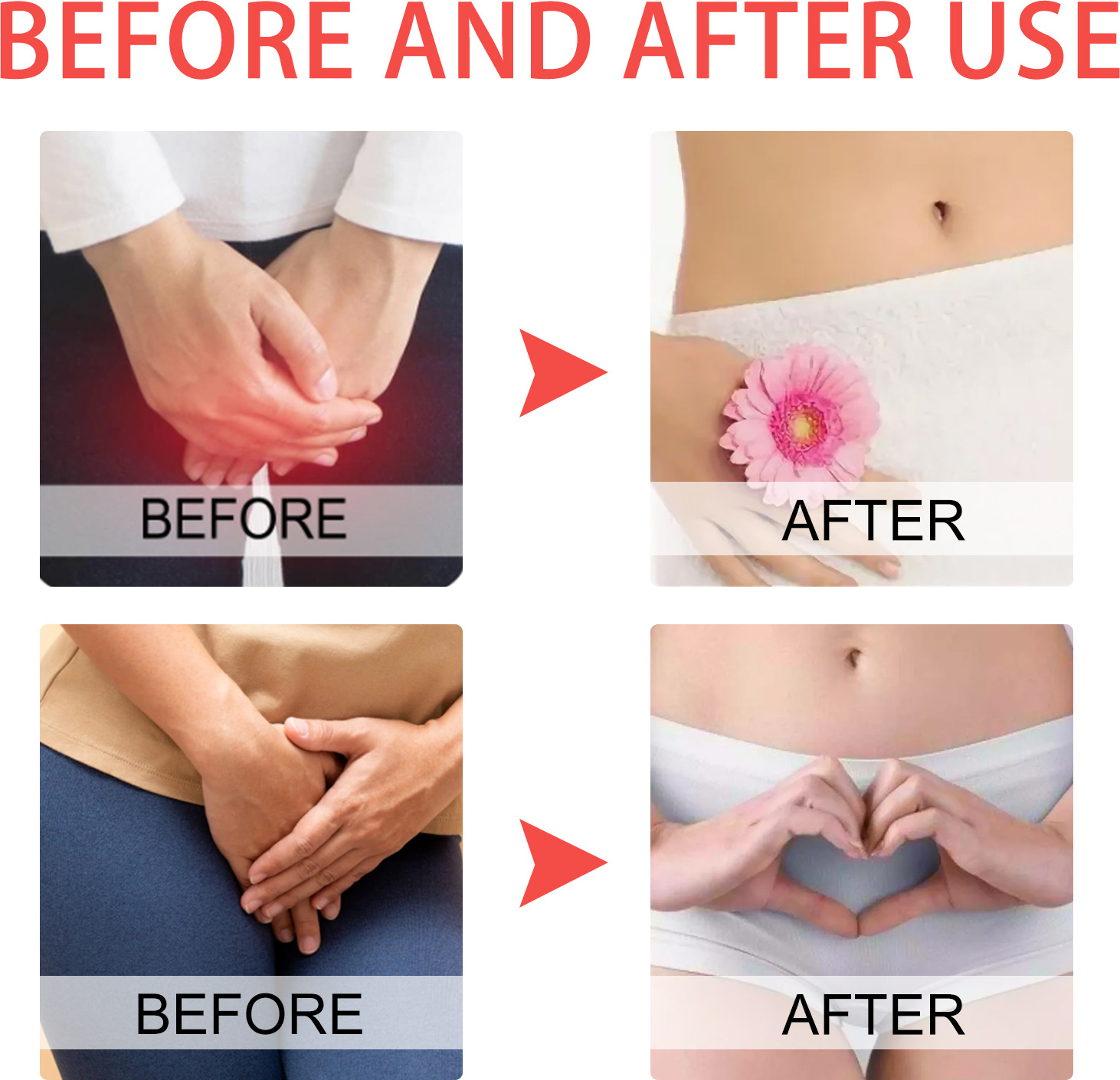 EELHOE Körpercreme für Frauen, lindert Juckreiz, Beschwerden, milde, unsaubere Geruchspflege_voghion.com