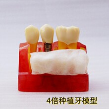 ���t ȫ���t�� 4���Nֲ��ģ������ǻ�o������ģ��