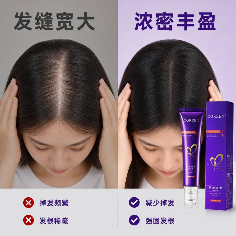 3D Ice-Sense Roll-On Plant Extract Scalp Nourishing Liquid: Prevents hair loss, strengthens hair, improves hair fall, reduces hair gaps, for those with sparse hair roots