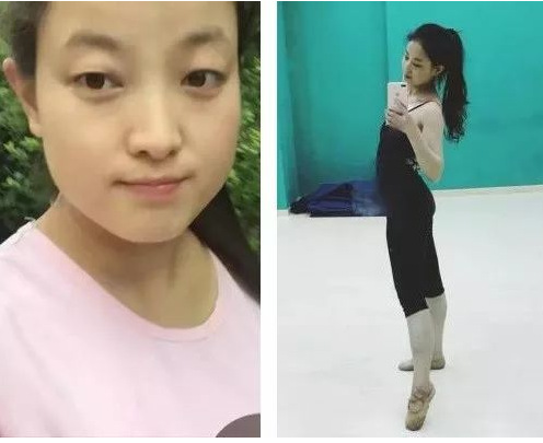 减肥前后对比图19