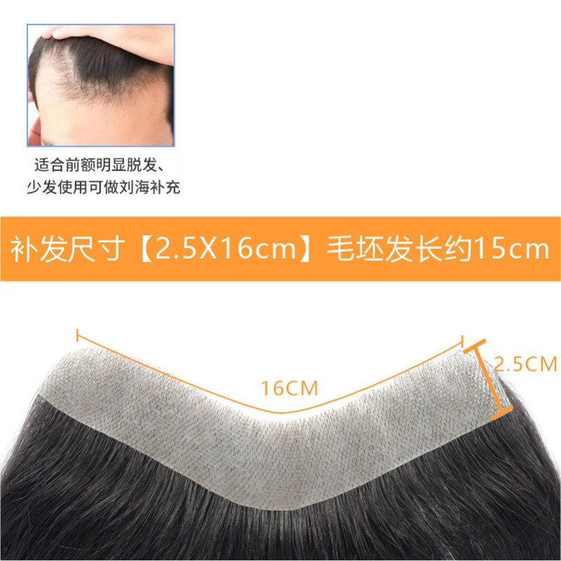 发际线假发贴假刘海假发片m形发际线贴男一片式前额补发自然真发|undefined