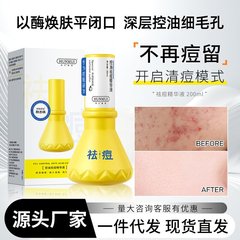 Han Lun Meiyu 抗ニキビエッセンスは、口を閉じ、ニキビ、黒ずみ、オイルコントロール、保湿、デリケートな毛穴、湿式圧縮エッセンス水を除去します。