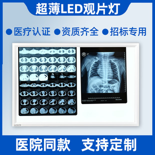 Hospital LED film viewing lamp box dental orthopedic lightweight remote control dimming X-ray film viewing lamp three double