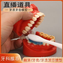 牙齿模型 仿真假一半蛀牙渍道具 牙科线刷牙直播展示坏牙齿模具