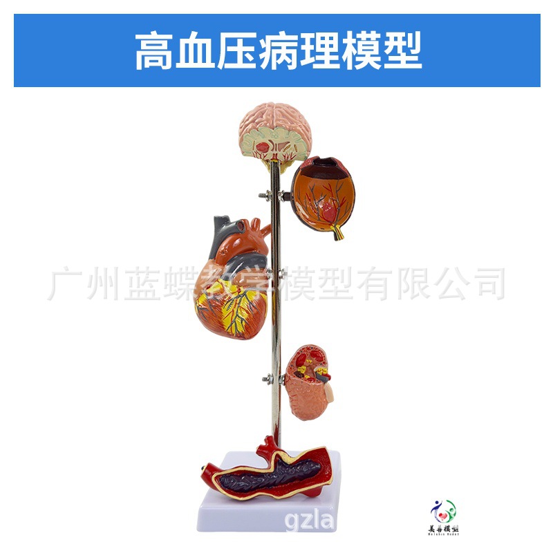 ��/Ѫѹģ�� ����/��������ģ�� ��̬������ ��Ѫѹ��������Ѫ��