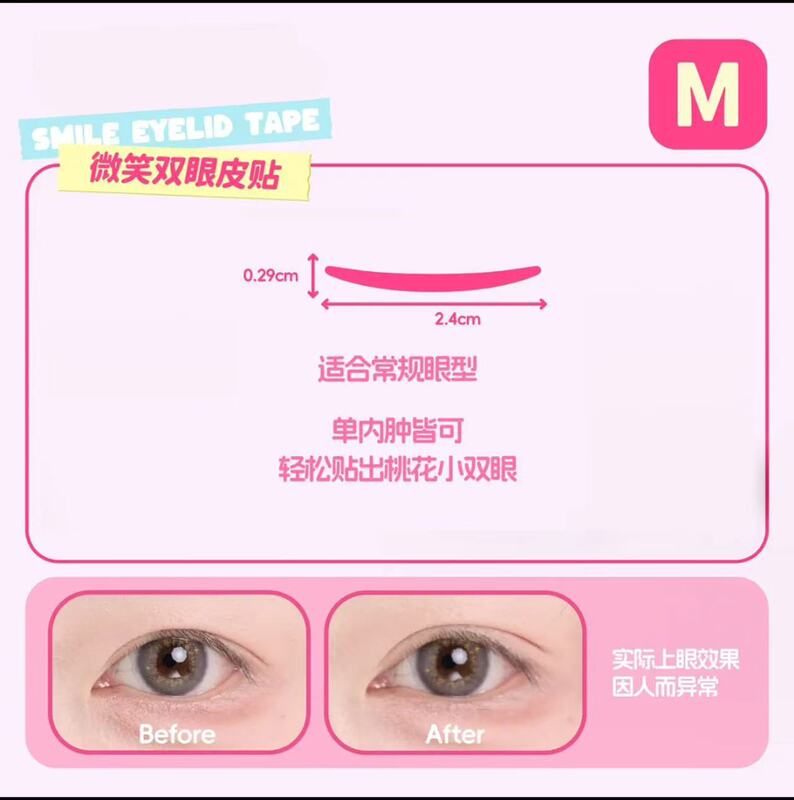 ティヨン泉のほほえみの二重まぶたはステルスを貼って長く持続します。|undefined