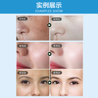 依克多因修护水 爽肤水修护喷雾增厚皮肤屏障保湿滋润