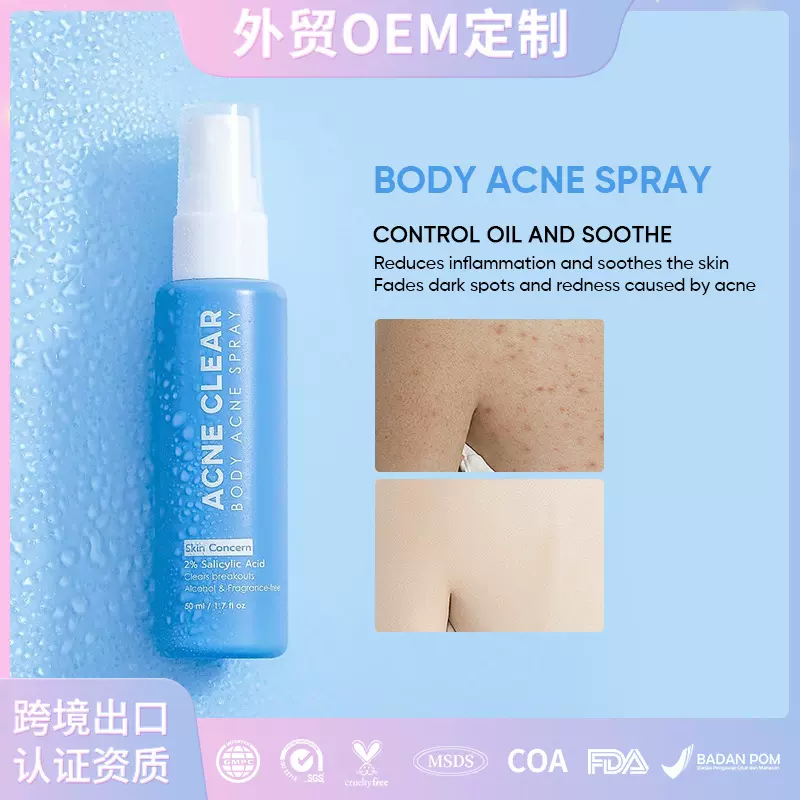 TK爆品OEM淡化痘印保湿喷雾水杨酸身体祛痘喷雾Body Acne Spray