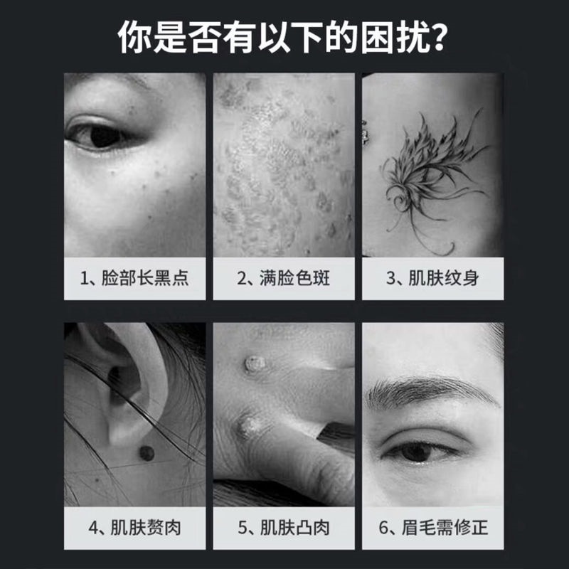 手持皮秒筆激光洗眉筆洗紋身掃斑紅藍光皮秒美容儀便攜式小型皮秒