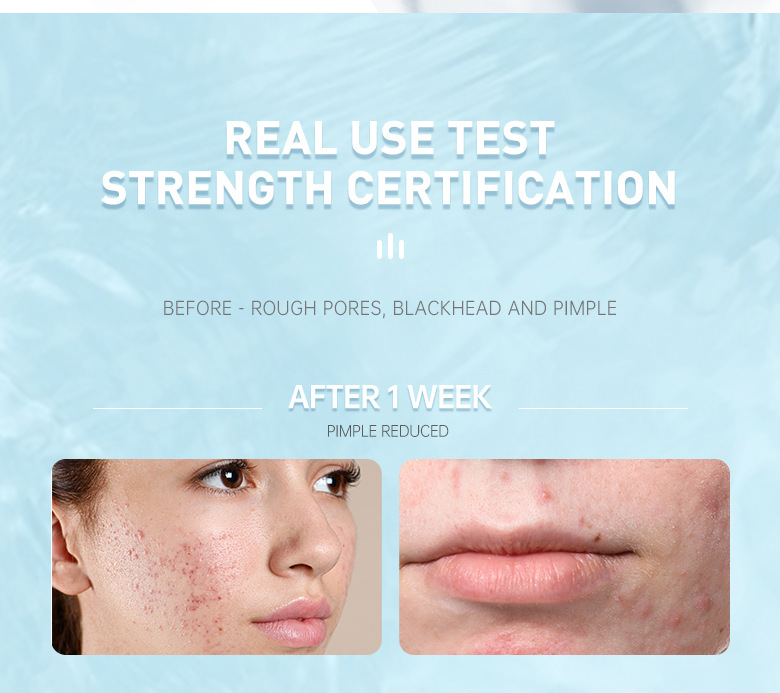 Salicylic Acid Repair Lotion