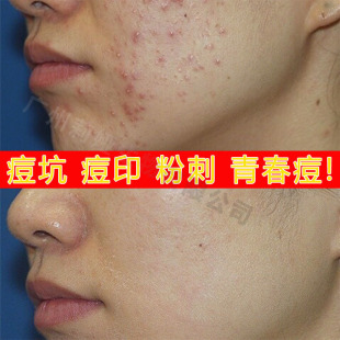 �˪�ݱ��������ӡ�۴̿����տsë����˪�沿���oȥ�����A˪