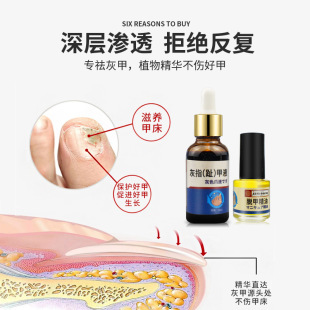 ͬ���ûҼ�Һ�㲿�o��Һ�������׻Ҽ׃�Ó��ܛ�׻�ָ�����o����