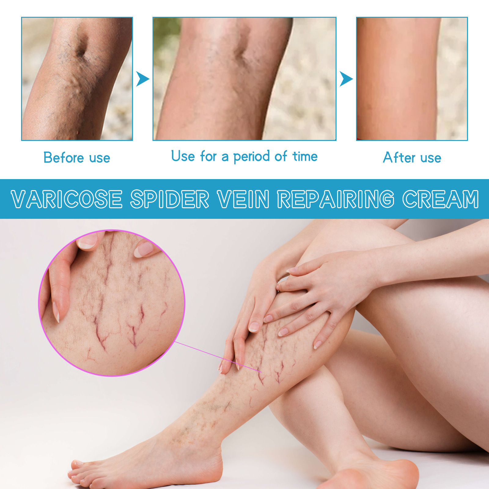 Lindert West&Month Repair Pain Regenwurm Bein prall gefüllte Venenpflege-Massagecreme_voghion.com