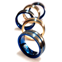 SҹlRFIDָܽ ɫմɲ| TiƬȹ