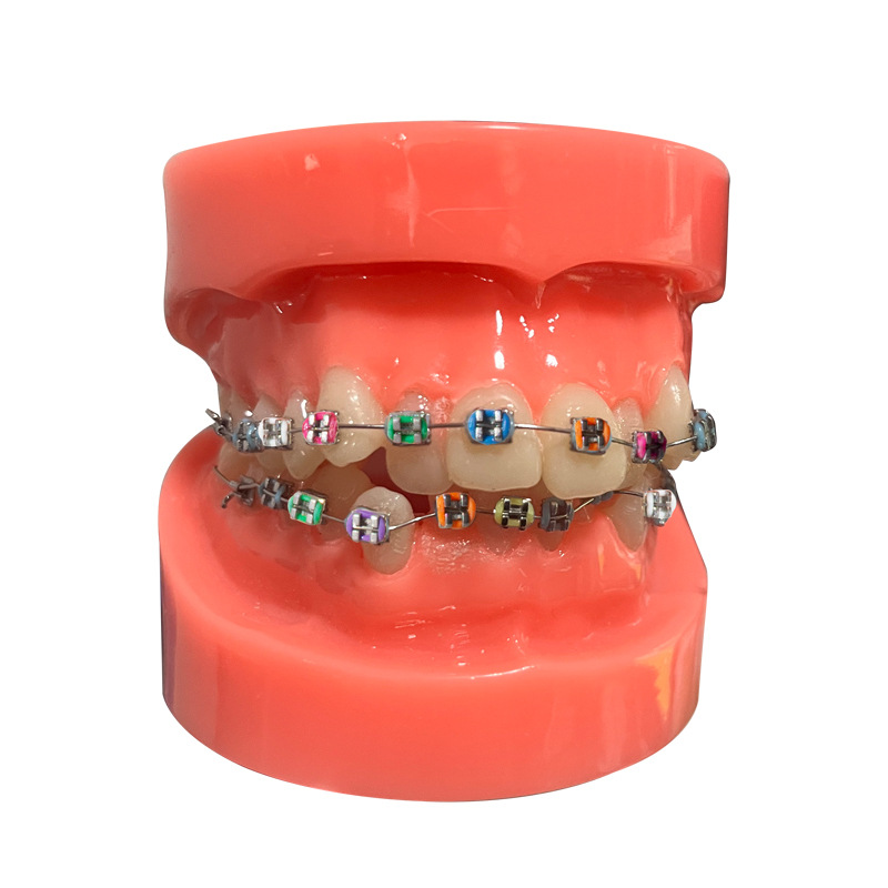 Modelo dental, modelo de corrección de demostración de mandíbula incorrecta, práctica de dentista, modelo de brackets pegajosos, molde de enseñanza de corrección
