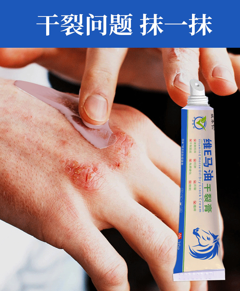 Yao Benren Vitamin E Horse Oil Cracked Skin Ointment 20g External Skin Care Balm specifications