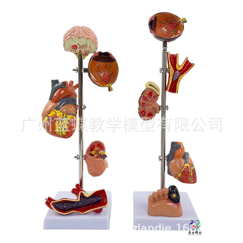 ��/Ѫѹģ�� ����/��������ģ�� ��̬������ ��Ѫѹ��������Ѫ��