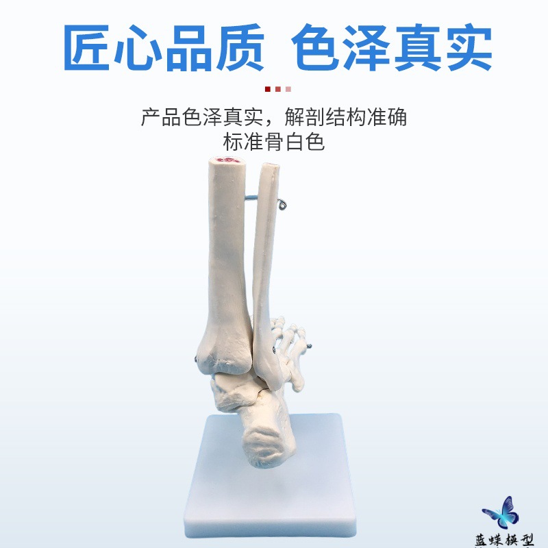 ����Źؽڸ��ʹ�ģ�� ����1:1 ��ؽڹ����˶�ϵͳ�����������