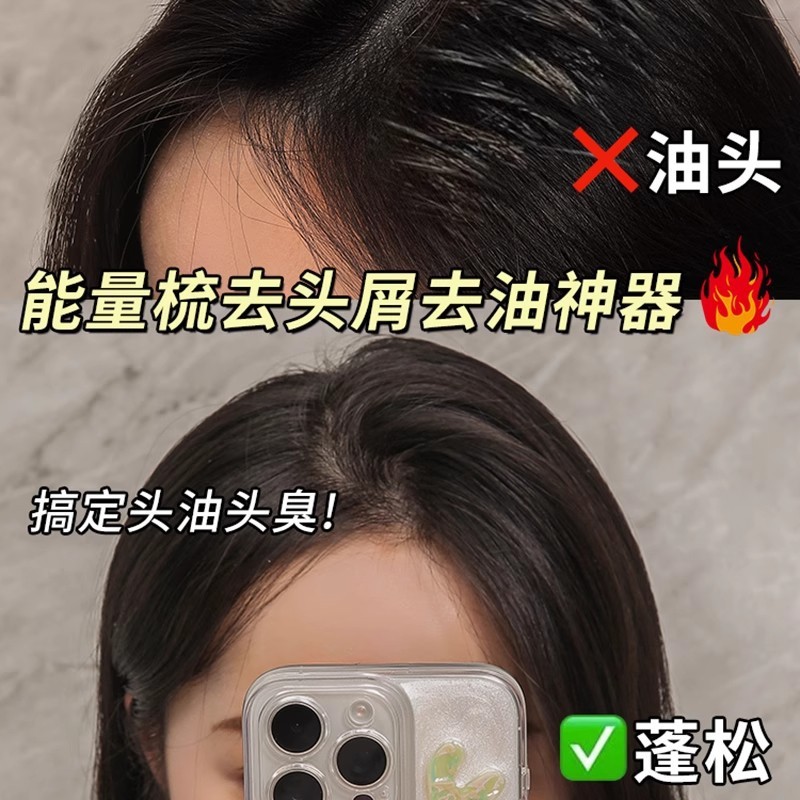 オイルヘッドエナジーコーム、頭皮中空コーム、オイルコントロール、フケ防止、洗い流さないヘアマッサージコーム、油分とフケを除去するクリーニングコーム|undefined