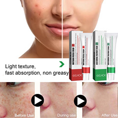 EELHOE 祛痘去斑霜 淡化斑點提亮膚色保濕皮膚痘痘色斑護膚修護霜