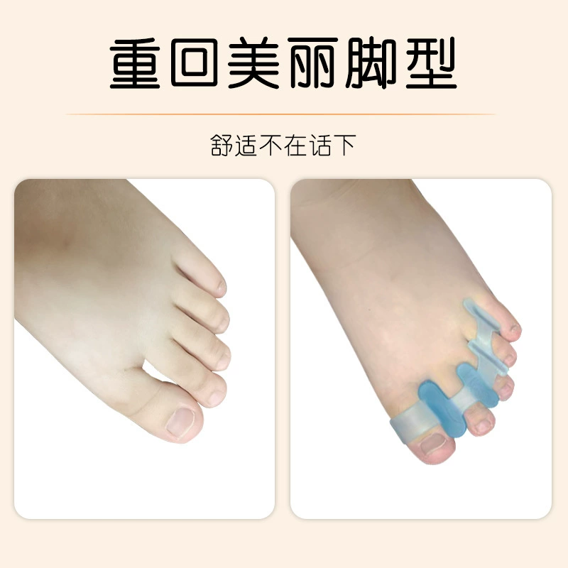 Производственный заказной сепаратор hallux valgus коррекции день и ночь с перекрывающимися пальцами SEBS мост типа разделителя пальцев
